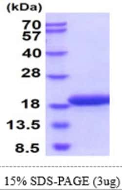 Novus Biologicals&trade;&nbsp;Recombinant Human gamma-Synuclein Protein